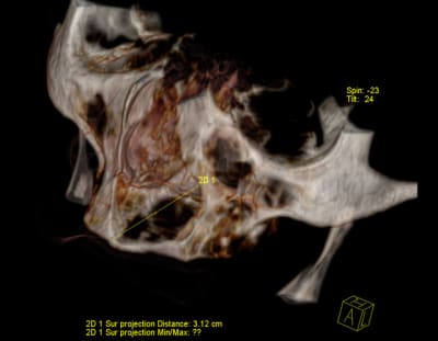Recons1 noz8lz - Eugenol
