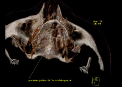 Recons3 kbwcaj - Eugenol
