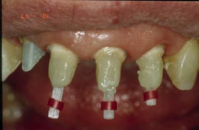 Reconstitution 2 fdsqnf - Eugenol