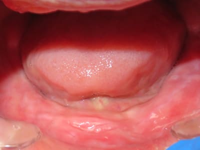 Relff2vujb86jdtpdyx4ax1lekqr - Eugenol