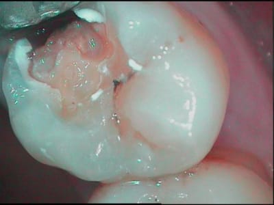Repffff yni8ua - Eugenol