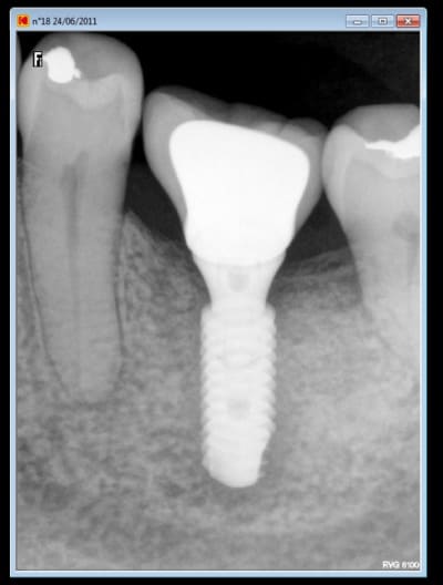 Resultat fhkd1x - Eugenol