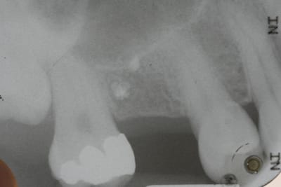 Retro avant g5t8km - Eugenol