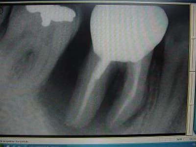 Retro0803 j629aw - Eugenol