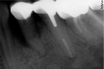 Retro34 xginyr - Eugenol