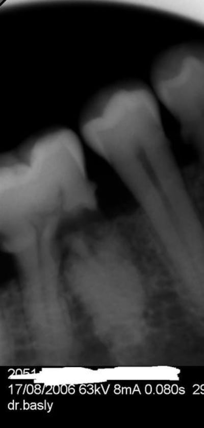 Retro rjo3ww - Eugenol