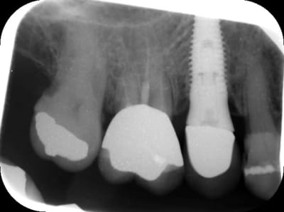 Rob2 xmvjx4 - Eugenol