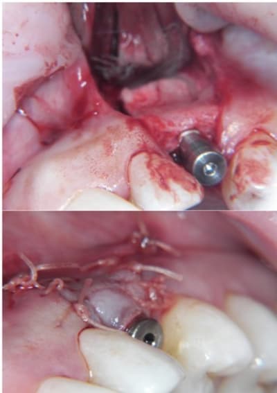 Rog5 enibgk - Eugenol