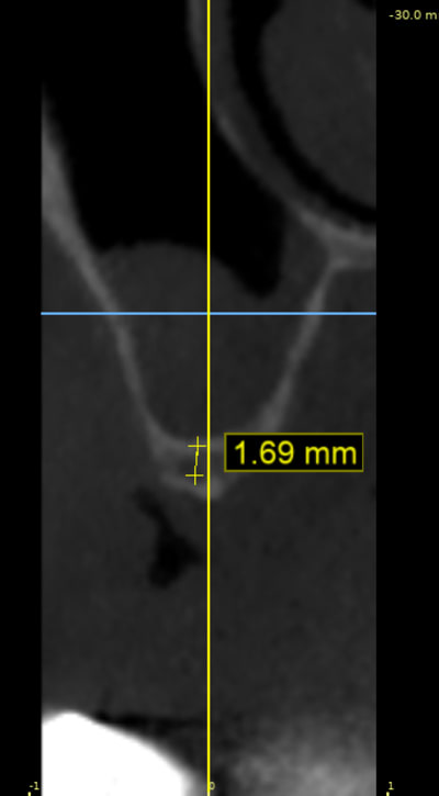 Rw5nxdjborbwgmib1vjm - Eugenol