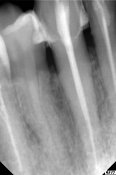 Rx1 jdg8md - Eugenol