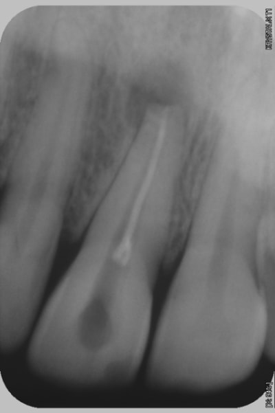 Sana0 wkzy9h - Eugenol