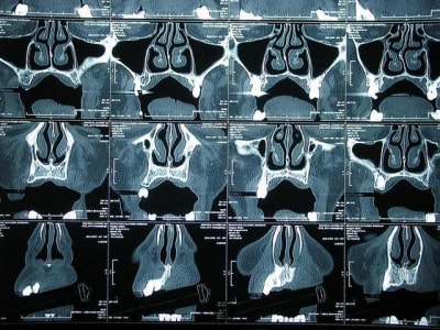 Scan1 t93yl3 - Eugenol