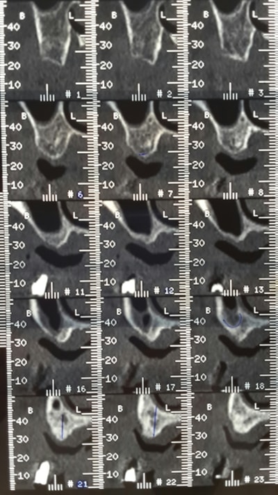 Scan2 altgys - Eugenol