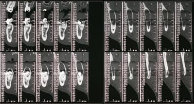 Scan2 zf7kx4 - Eugenol