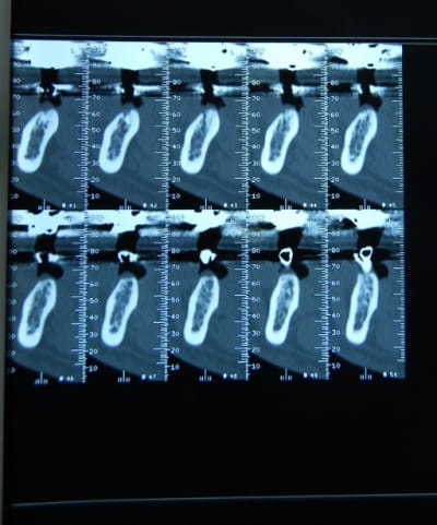 Scan3 aylwep - Eugenol