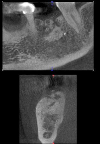 Scan 1 vhqitz - Eugenol