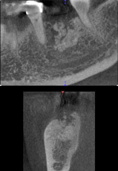 Scan 2 o60uts - Eugenol