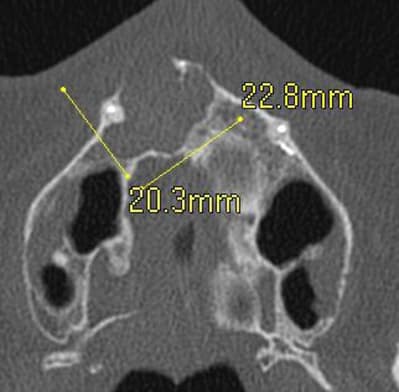 Scan 2 t8y1bi - Eugenol