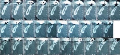 Scan bas gauche hdqiib - Eugenol