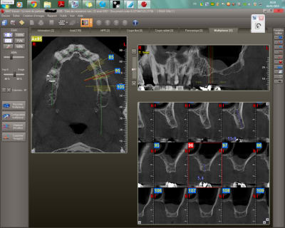 Scan gfthng - Eugenol