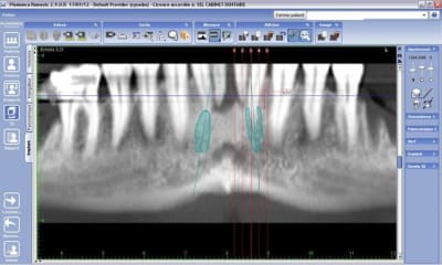 Scan ijk8ef - Eugenol