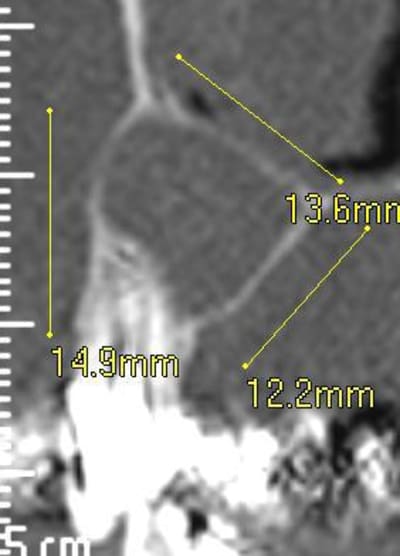 Scan profil en  12 gkivm8 - Eugenol