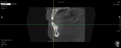 Scan t6kdxv - Eugenol