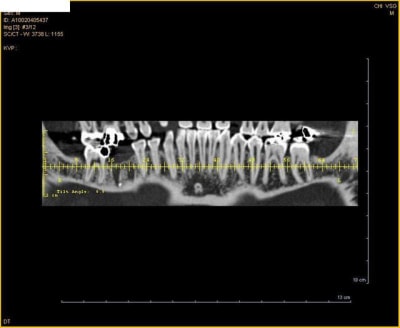 Scann2 jp6ltd - Eugenol