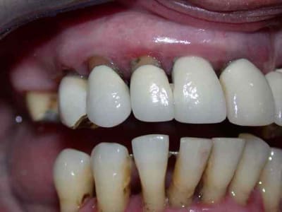 Secteur droit pwxfua - Eugenol