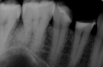 Sedd 2 ntfigk - Eugenol