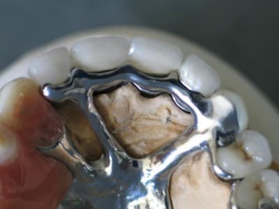 Selle disjointe 2 xwvyom - Eugenol