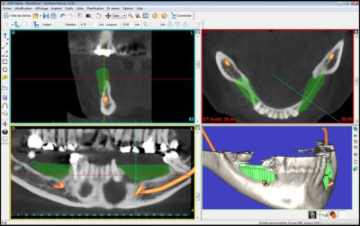 Simulation greffe iwz2t7 - Eugenol