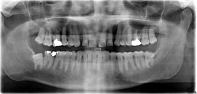 Sinusd cb3lqo - Eugenol