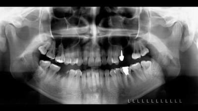 Slide 001 copunm - Eugenol