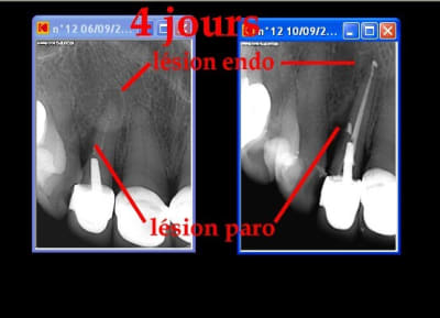 Snoopy letx0h - Eugenol