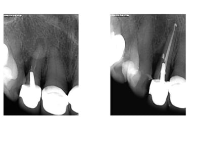 Snoopy yzlynw - Eugenol