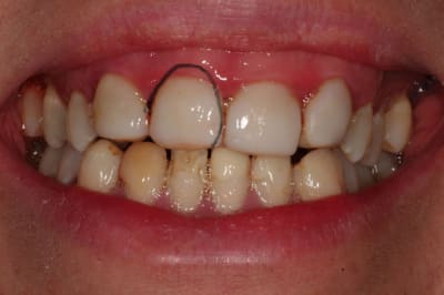 Souredit iopy10 - Eugenol