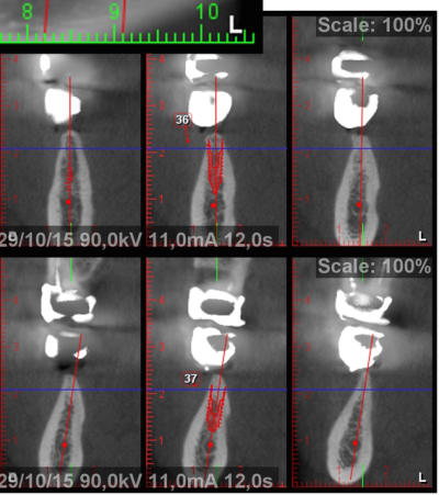 Split2 bydzgl - Eugenol