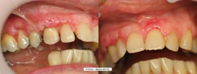 Suite cas 1 fcpixd - Eugenol
