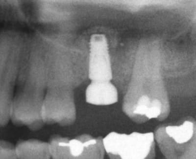 Summers zuc8el - Eugenol