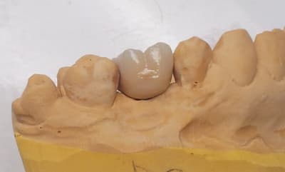 Surplomb 2 jtwfcs - Eugenol