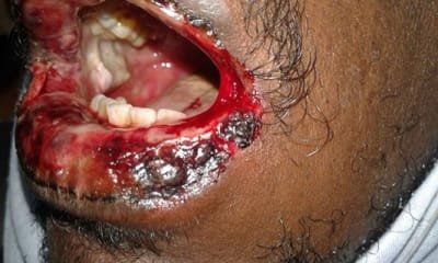 T46kkcj8vvmu0set7ahz - Eugenol