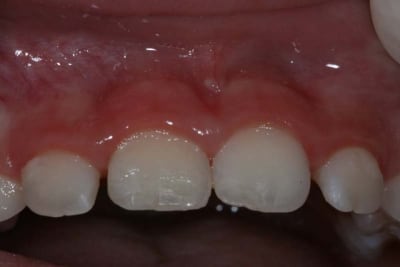 Tarah maya jy9jrz - Eugenol