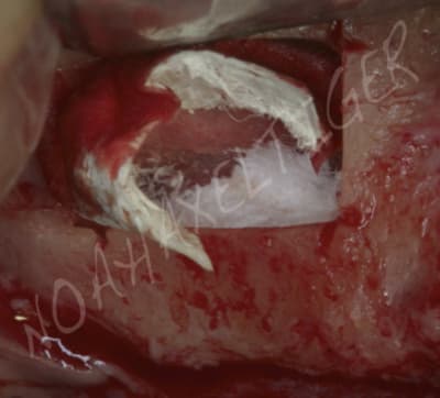 Technique chaussette rdjugz - Eugenol