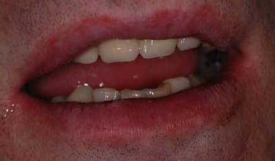 Termine uh2xhd - Eugenol