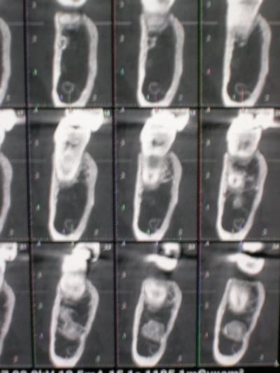 Tgpipa0hqb6rt8wkj3xi - Eugenol