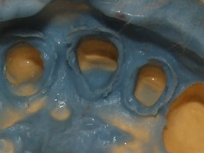 Tirage tq1eo3 - Eugenol