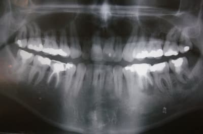 Trucmuche pwgngj - Eugenol