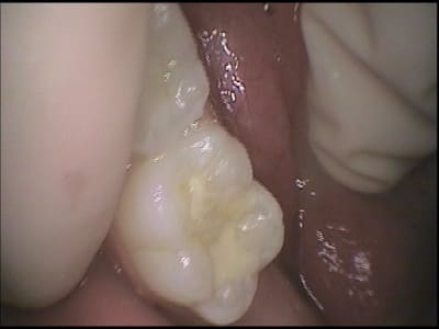 Tyler fuji ix a4tj1e - Eugenol