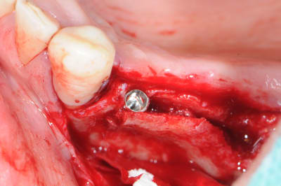 U6teu0lk78lq1ywy4b5s - Eugenol